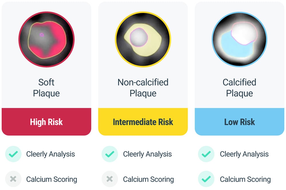 patient-ed_caleery-vs-calcium-scoring